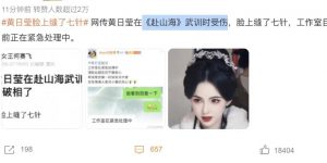 “天哪，她和李若彤超像的！30岁女演员武训时不小心受伤，脸上缝了7针”缩略图